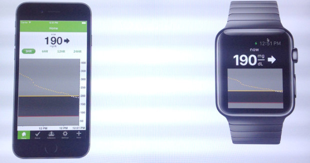 DexCom glucose monitoring Apple Watch app